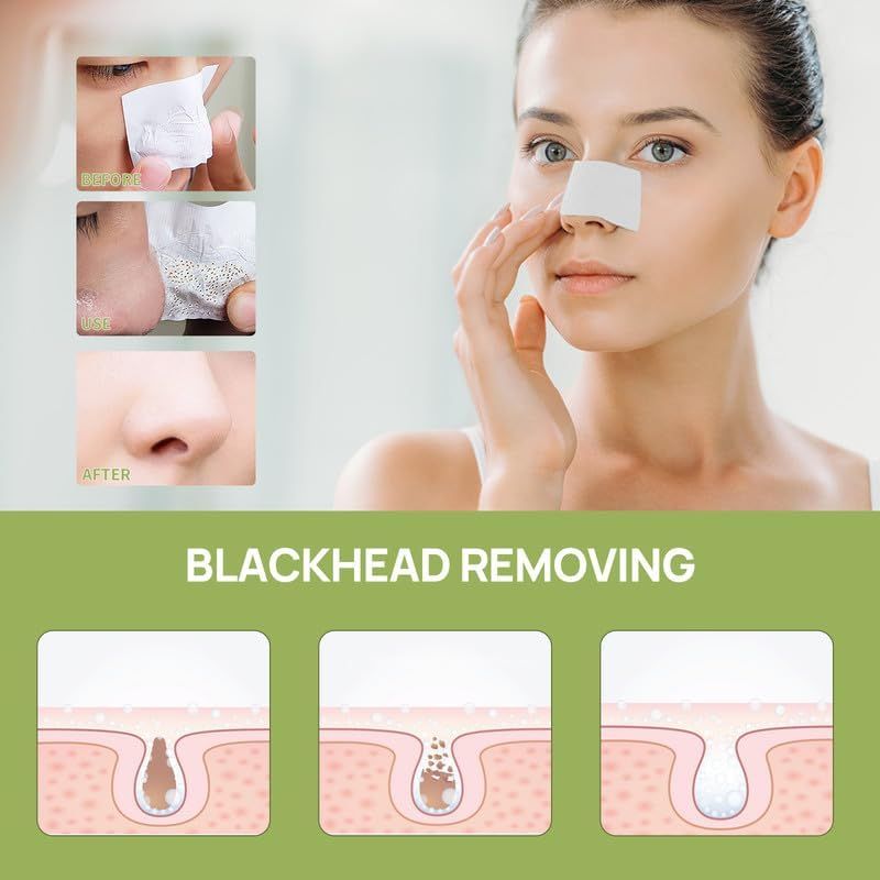 LANBENA Blackhead Remover Cream