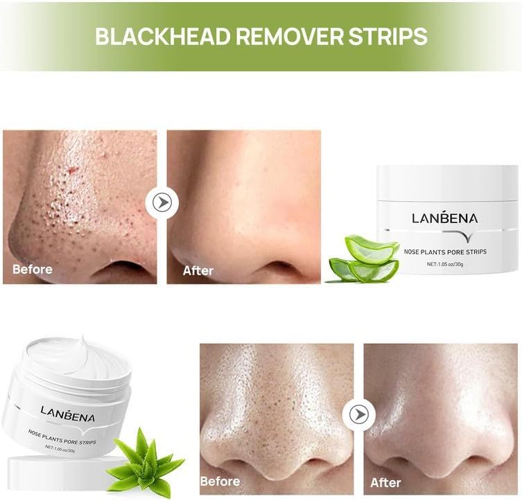 LANBENA Blackhead Remover Cream